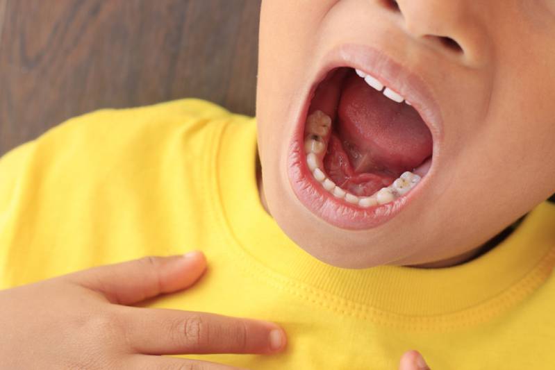 Why is my tongue itchy